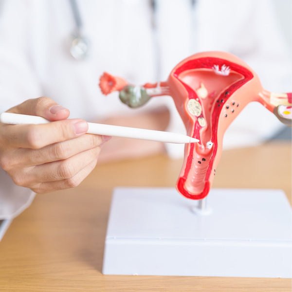 Endometriosis