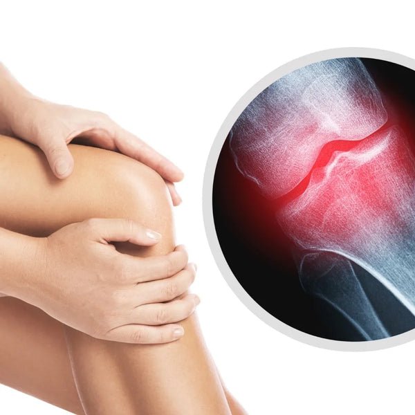 Osteoarthritis